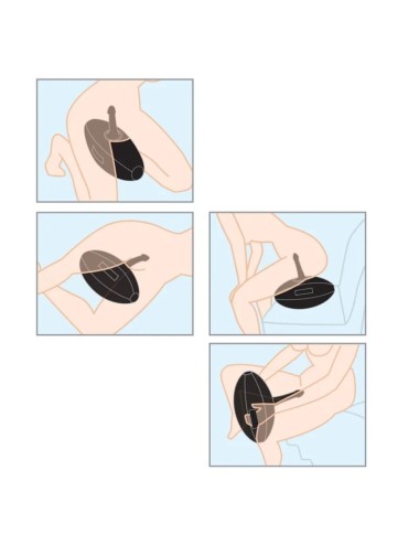9 CM